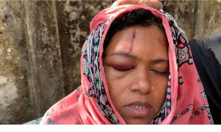 চৌদ্দগ্রামে পারিবারিক বিরোধের জেরে প্রতিপক্ষের হামলায় মহিলা, শিশুসহ আহত ৬  ‎